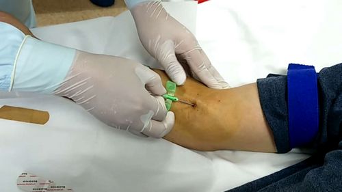 (6)要养成早晚检查动静脉内瘘是否通畅的习惯.