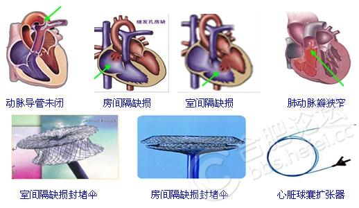 图片13.png